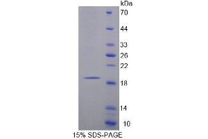 SDS-PAGE analysis of Rat MARCO Protein. (MARCO Protein)