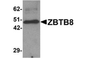 Western blot analysis of ZBTB8 in mouse spleen tissue lysate with ZBTB8 antibody at 1 μg/ml. (ZBTB8A antibody  (C-Term))