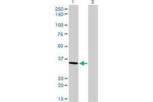 Western Blot analysis of AKR7A2 expression in transfected 293T cell line by AKR7A2 monoclonal antibody (M01), clone 2A6. (AKR7A2 antibody  (AA 1-330))