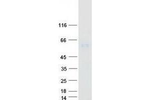 UGT1A4 Protein (Myc-DYKDDDDK Tag)