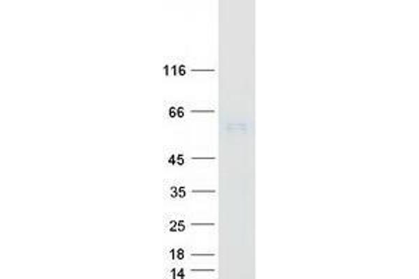 UGT1A4 Protein (Myc-DYKDDDDK Tag)