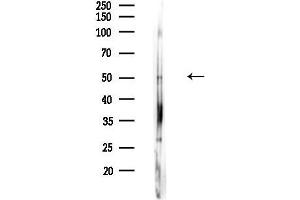 anti-Proteasome (Prosome, Macropain) 26S Subunit, ATPase, 4 (PSMC4) (C-Term) antibody