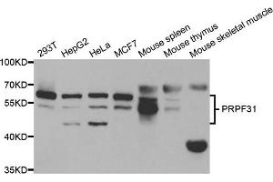 Western blot analysis of extracts of various cell lines, using PRPF31 antibody.
