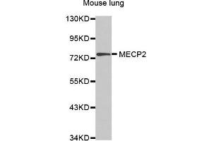 MECP2 抗体  (AA 1-280)