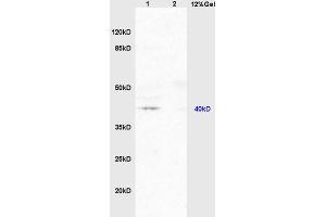 Lane 1: mouse brain lysates Lane 2: mouse embryo lysates probed with Anti PAR-2 Polyclonal Antibody, Unconjugated (ABIN738816) at 1:200 in 4 °C. (NR1I2 antibody  (AA 101-150))