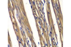 Immunohistochemistry of paraffin-embedded Rat heart using PTPN2 Polyclonal Antibody at dilution of 1:100 (40x lens). (PTPN2 antibody)