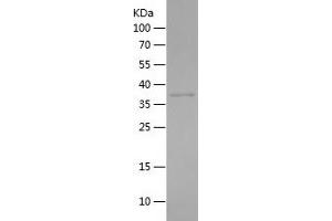 Western Blotting (WB) image for Aldo-Keto Reductase Family 1, Member E2 (AKR1E2) (AA 201-320) protein (His-IF2DI Tag) (ABIN7282238) (AKR1E2 Protein (AA 201-320) (His-IF2DI Tag))