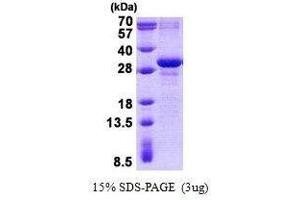 Figure annotation denotes ug of protein loaded and % gel used. (MXD3 Protein)