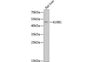 Western blot analysis of extracts of rat liver, using KLRB1 antibody (ABIN6130055, ABIN6142970, ABIN6142972 and ABIN6222669) at 1:3000 dilution. (CD161 antibody  (AA 73-140))