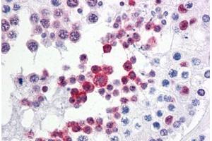 Human Testis: Formalin-Fixed, Paraffin-Embedded (FFPE) (TP53RK antibody  (AA 1-254))
