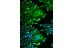 Immunofluorescence analysis of A549 cell using CACNG4 antibody. (CACNG4 antibody)