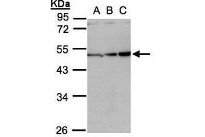 WB Image Sample(30 ug whole cell lysate) A:H1299 B:HeLa S3, C:Hep G2 , 10% SDS PAGE antibody diluted at 1:1000 (INHBA antibody  (C-Term))