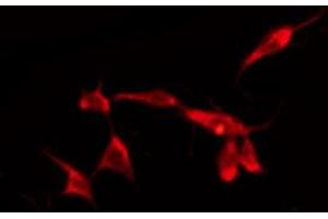 ABIN6274608 staining HepG2 by IF/ICC. (CADM2 antibody  (Internal Region))
