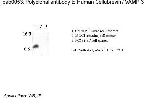 Image no. 2 for anti-Vesicle-Associated Membrane Protein 3 (VAMP3) (N-Term) antibody (ABIN347002) (VAMP3 antibody  (N-Term))