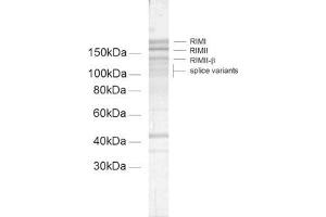 dilution: 1 : 100, sample: crude synaptic membranes fraction of rat brain (LP1) (RIMS2 antibody  (AA 461-987))