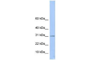 WB Suggested Anti-ECHDC1 Antibody Titration:  0. (ECHDC1 antibody  (Middle Region))