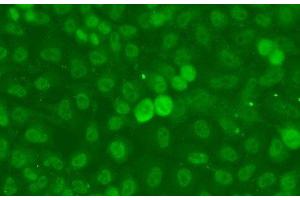 Immunofluorescence analysis of A549 cells using SSNA1 Polyclonal Antibody (SSNA1 antibody)