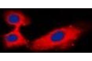 Immunofluorescent analysis of Rabphilin 3A staining in Hela cells. (RPH3A antibody)