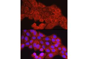 Immunofluorescence analysis of  cells using [KO Validated] SCD Rabbit pAb (ABIN7270589) at dilution of 1:150 (40x lens). (SCD antibody  (C-Term))