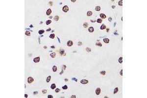 Immunohistochemical analysis of Ikaros staining in human kidney formalin fixed paraffin embedded tissue section. (IKZF1 antibody)