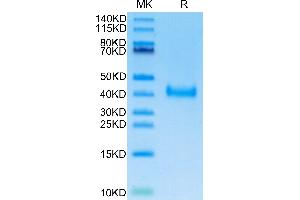 SARS-Cov-2 Spike RBD (Omicron BA. (SARS-CoV-2 Spike Protein (BA.2.12.1 - Omicron, RBD) (His tag))