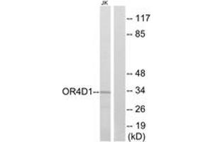 Western blot analysis of extracts from Jurkat cells, using OR4D1 Antibody. (OR4D1 antibody  (AA 261-310))