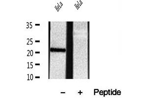 Western blot analysis of extracts of HeLa cells, using REEP5 antibody.