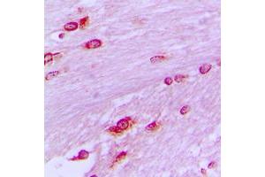 Immunohistochemical analysis of BUB3 staining in human brain formalin fixed paraffin embedded tissue section.