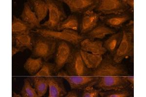 Immunofluorescence analysis of U-2 OS cells using STUB1 Polyclonal Antibody at dilution of 1:100 (40x lens). (STUB1 antibody)