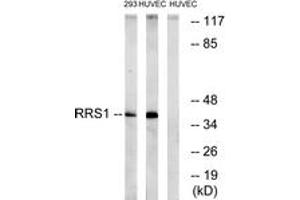 Western blot analysis of extracts from HuvEc/293 cells, using RRS1 Antibody. (RRS1 antibody  (AA 254-303))