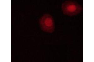 Immunofluorescence (fixed cells) (IF/ICC) image for anti-SNF1A/AMP-Activated Protein Kinase (SNF1A) (pThr172) antibody (ABIN6255610)