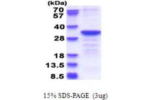 SDS-PAGE (SDS) image for Cytochrome B5 Reductase 2 (CYB5R2) (AA 1-276) protein (His tag) (ABIN5853701)