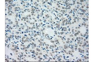Immunohistochemical staining of paraffin-embedded pancreas tissue using anti-MAP2K4mouse monoclonal antibody. (MAP2K4 antibody)