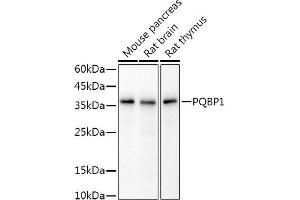 Western blot analysis of extracts of various cell lines, using PQBP1 antibody (ABIN7269452) at 1:1000 dilution. (PQBP1 antibody)