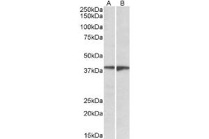 ABIN2562358 (1µg/ml) staining of Human Frontal Cortex (A) and Amygdala (B) lysates (35µg protein in RIPA buffer). (S1PR5 antibody  (Internal Region))