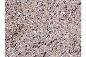 IHC-P Image DPF2 antibody detects DPF2 protein at cytoplasm and nucleus on mouse brain by immunohistochemical analysis. (DPF2 antibody  (Center))