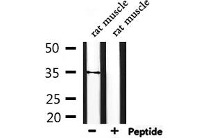 Western blot analysis of extracts from rat muscle, using TAS2R44 Antibody. (TAS2R31 antibody)
