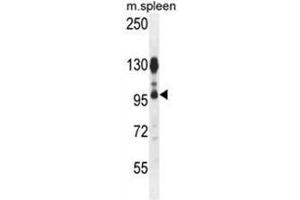ACAP1 Antibody (N-term) western blot analysis in mouse spleen tissue lysates (35 µg/lane). (ACAP1 antibody  (N-Term))