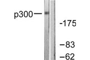 Western blot analysis of extracts from MDA-MB-435 cells, using p300 Antibody. (p300 antibody  (AA 1-50))