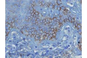 Immunohistochemistry (IHC) image for anti-Complement Fragment 3d (C3d) (N-Term) antibody (ABIN870581)