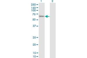Western Blotting (WB) image for anti-RuvB-Like 1 (E. Coli) (RUVBL1) (AA 1-456) antibody (ABIN563710)