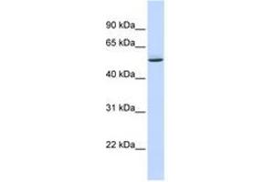 Image no. 1 for anti-GTP-Binding Protein 10 (GTPBP10) (AA 144-193) antibody (ABIN6740786) (GTPBP10 antibody  (AA 144-193))