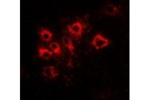 Immunofluorescent analysis of Tapasin staining in Hela cells. (TAPBP antibody)