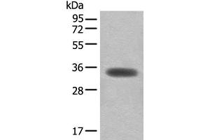 Western blot analysis of Mouse skeletal muscle tissue lysate using MYOZ2 Polyclonal Antibody at dilution of 1:450 (MYOZ2 antibody)