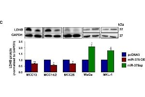 miR-375 regulates LDHB mRNA and protein levels. (LDHB antibody  (AA 1-334))