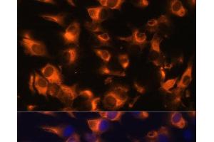 Immunofluorescence analysis of C6 cells using SSTR2 Polyclonal Antibody at dilution of 1:100 (40x lens). (SSTR2 antibody)