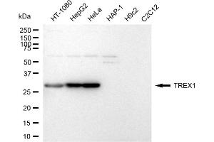 Western blotting analysis using TREX1 antibody (ABIN7800547).