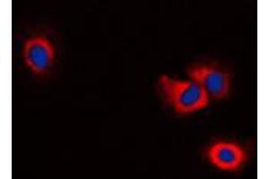 Immunofluorescent analysis of ERAP1 staining in NIH3T3 cells. (ERAP1 antibody  (Center))