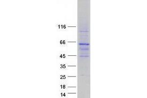 YY2 Protein (Myc-DYKDDDDK Tag)