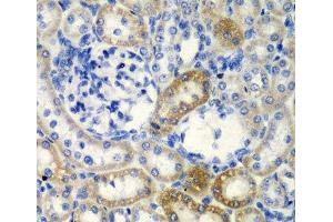 Immunohistochemistry of paraffin-embedded Rat kidney using DCTD Polyclonal Antibody at dilution of 1:200 (40x lens). (DCMP Deaminase (DCTD) antibody)